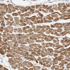 Immunohistochemical staining of human heart muscle shows moderate to strong cytoplasmic positivity in myocytes.