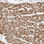 Immunohistochemical staining of human heart muscle shows moderate to strong cytoplasmic positivity in myocytes.