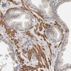 Immunohistochemical staining of human prostate shows strong cytoplasmic positivity in smooth muscle cells.