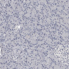 Anti-MAP7D1 Antibody