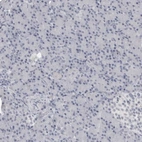 Immunohistochemical staining of human pancreas shows no positivity in exocrine glandular cells as expected.