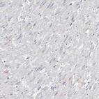 Anti-AMPD1 Antibody