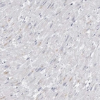 Immunohistochemical staining of human heart muscle shows low expression as expected.