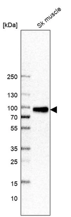 Western blot analysis in human skeletal muscle tissue.