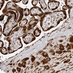 Anti-ALPK2 Antibody
