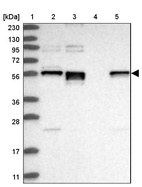 Lane 1: Marker [kDa] 230, 130, 95, 72, 56, 36, 28, 17, 11_br/_Lane 2: Human cell line RT-4_br/_Lane 3: Human cell line U-251MG sp_br/_Lane 4: Human plasma (IgG/HSA depleted)_br/_Lane 5: Human liver tissue
