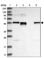 Lane 1: Marker [kDa] 230, 130, 95, 72, 56, 36, 28, 17, 11_br/_Lane 2: Human cell line RT-4_br/_Lane 3: Human cell line U-251MG sp_br/_Lane 4: Human plasma (IgG/HSA depleted)_br/_Lane 5: Human liver tissue