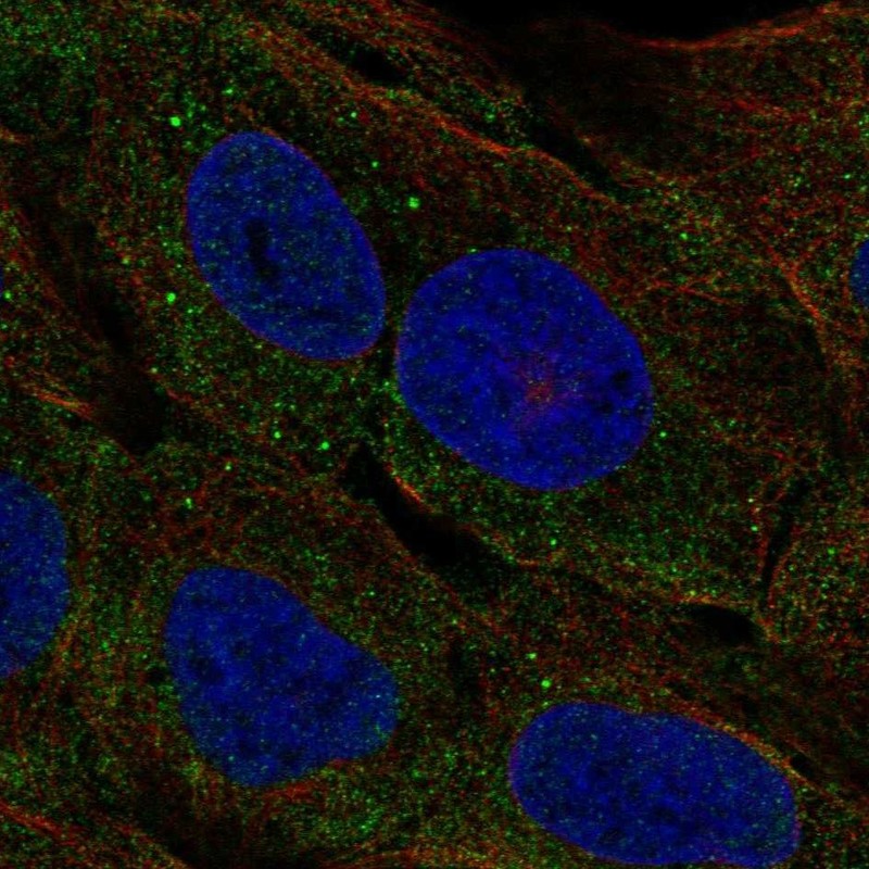 Anti-CELA3A Antibody