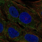 Anti-CELA3A Antibody