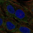 Anti-CELA3A Antibody