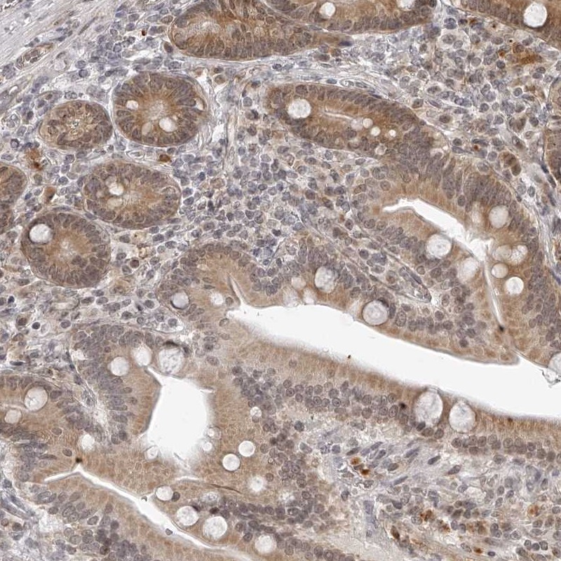 Anti-ODF2L Antibody