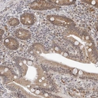Anti-ODF2L Antibody