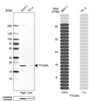 Western blot analysis in human cell lines MCF-7 and PC-3 using Anti-TTC39A antibody. Corresponding TTC39A RNA-seq data are presented for the same cell lines. Loading control: Anti-COX4I1.