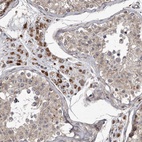 Immunohistochemical staining of human testis shows high expression.