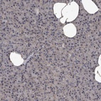 Immunohistochemical staining of human pancreas shows low expression as expected.