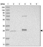 Lane 1: Marker [kDa] 230, 130, 95, 72, 56, 36, 28, 17, 11_br/_Lane 2: Human cell line RT-4_br/_Lane 3: Human cell line U-251MG sp_br/_Lane 4: Human plasma (IgG/HSA depleted)_br/_Lane 5: Human liver tissue_br/_Lane 6: Human tonsil tissue