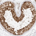 Immunohistochemical staining of human testis shows strong cytoplasmic and nuclear positivity in cells in seminiferous ducts.