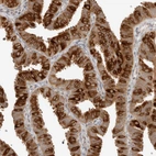 Immunohistochemical staining of human Fallopian tube shows strong cytoplasmic positivity in glandular cells.
