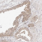 Immunohistochemical staining of human prostate shows weak cytoplasmic positivity in glandular cells.