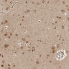 Immunohistochemical staining of human cerebral cortex shows weak to moderate cytoplasmic and nuclear positivity in neurons.