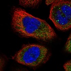 Immunofluorescent staining of human cell line A-431 shows localization to cytosol.