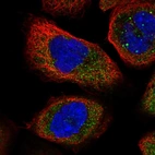 Immunofluorescent staining of human cell line A-431 shows localization to cytosol.