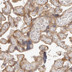 Immunohistochemical staining of human placenta shows moderate cytoplasmic positivity in trophoblastic cells.