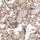 Immunohistochemical staining of human placenta shows moderate cytoplasmic positivity in trophoblastic cells.