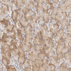 Immunohistochemical staining of human stomach shows moderate cytoplasmic positivity in glandular cells.