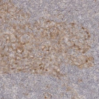 Immunohistochemical staining of human tonsil shows weak cytoplasmic positivity in squamous epithelial cells.