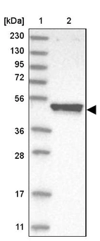 Lane 1: Marker [kDa] 230, 130, 95, 72, 56, 36, 28, 17, 11_br/_Lane 2: Human cell line RT-4
