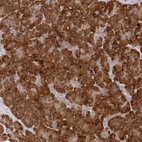 Anti-ARHGEF10L Antibody