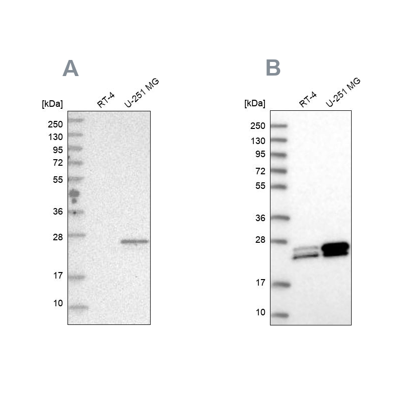 Anti-GUK1 Antibody