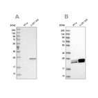 Anti-GUK1 Antibody