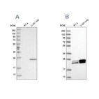 Anti-GUK1 Antibody