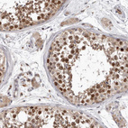 Immunohistochemical staining of human testis shows moderate to strong nuclear positivity in cells in seminiferous ducts.