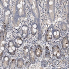 Immunohistochemical staining of human duodenum shows strong nuclear positivity in a subset of glandular cells.