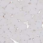 Immunohistochemical staining of human skeletal muscle shows no positivity in myocytes as expected.