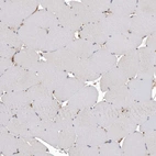 Immunohistochemical staining of human skeletal muscle shows no positivity in myocytes as expected.