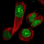 Immunofluorescent staining of human cell line U-251 MG shows localization to nucleus & nucleoli.