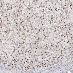 Anti-NTPCR Antibody