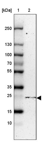 Lane 1: Marker [kDa] 250, 130, 100, 70, 55, 35, 25, 15, 10_br/_Lane 2: Human cell line HEK 293