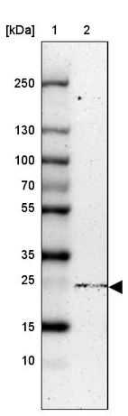 Lane 1: Marker [kDa] 250, 130, 100, 70, 55, 35, 25, 15, 10_br/_Lane 2: Human cell line HEK 293