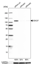 Western blot analysis in U2OS cells transfected with control siRNA, target specific siRNA probe #1 and #2, using Anti-CDC27 antibody. Remaining relative intensity is presented. Loading control: Anti-GAPDH.