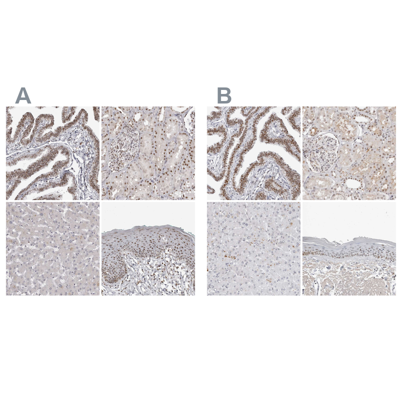 Anti-WRAP53 Antibody