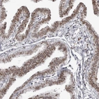 Immunohistochemical staining of human Fallopian tube shows moderate nuclear positivity in glandular cells.