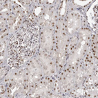 Immunohistochemical staining of human kidney shows weak to moderate nuclear positivity in cells in tubules.