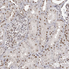 Anti-WRAP53 Antibody