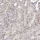 Immunohistochemical staining of human kidney shows weak to moderate nuclear positivity in cells in tubules.