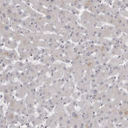 Immunohistochemical staining of human liver shows no positivity in hepatocytes as expected.